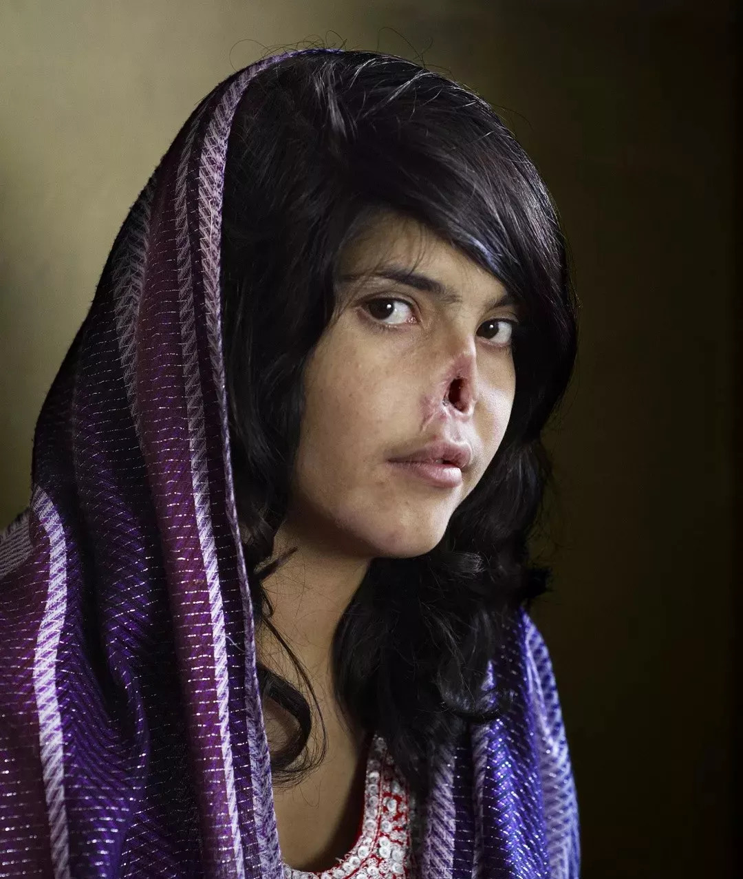 6. 因试图离开丈夫,而被塔利班武装组织割去鼻子跟耳朵的阿富汗女子.