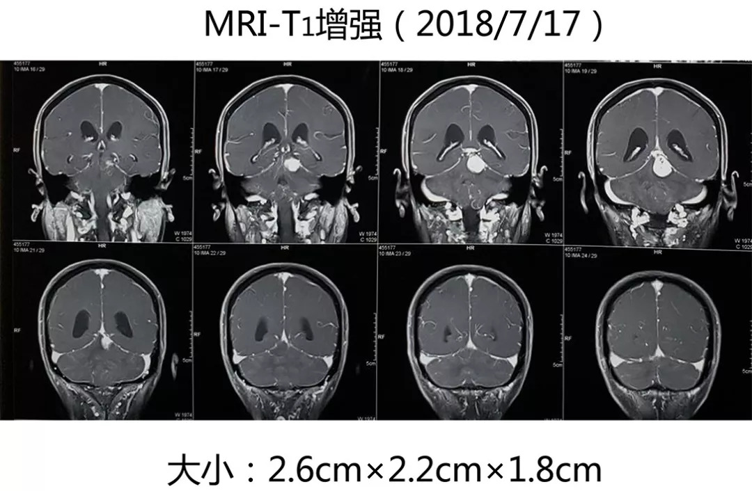 切除快播高清