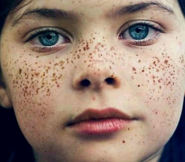 美国 小女孩脸部的雀斑颗粒比较大,有一种纯真却又美好的感觉.