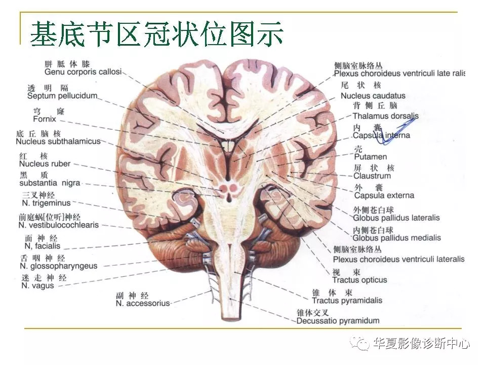 脑mri常用解剖