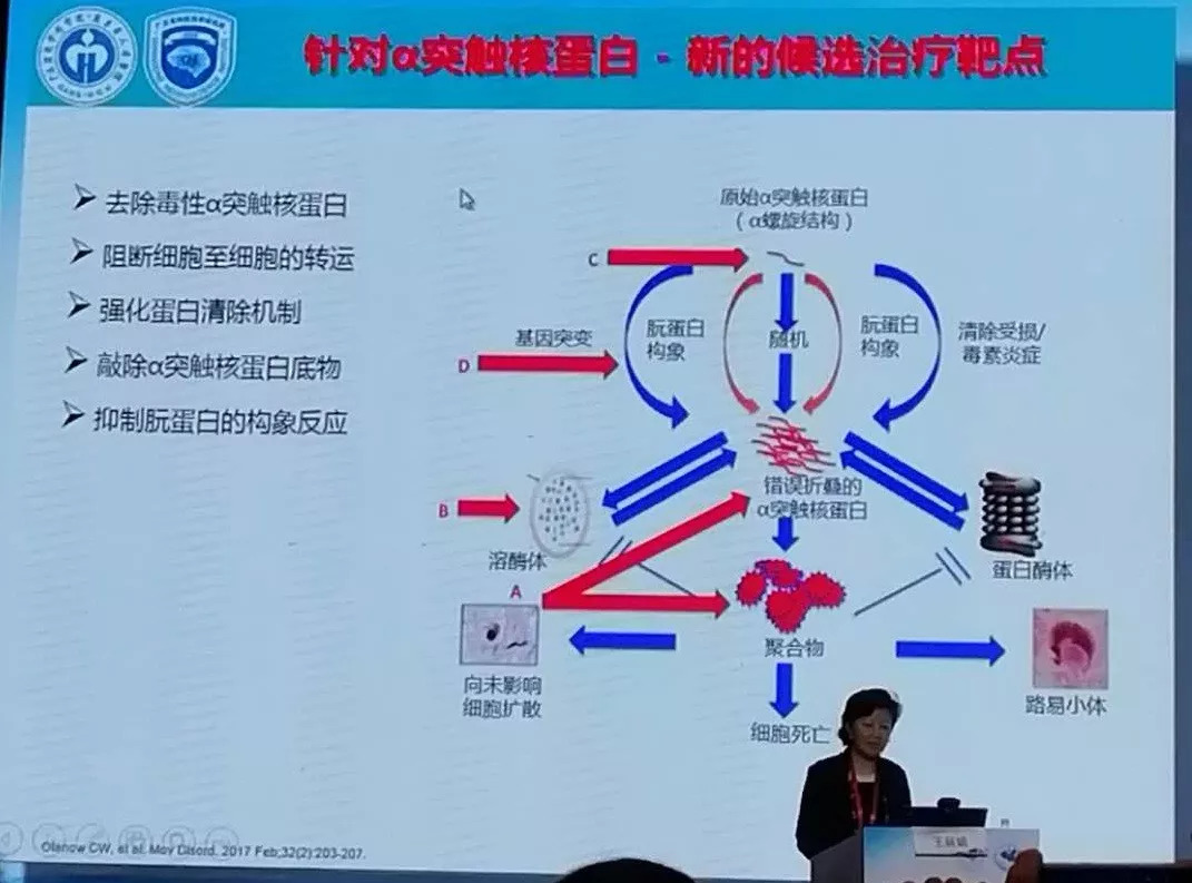 2018ncn帕金森专场2帕金森病最新治疗进展从饮食到可穿戴设备大开你的