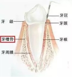 牙拔掉了有个洞怎么办