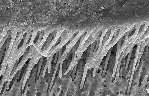 参与玷污层与渗入的树脂单体形成杂化层的,与渗入牙本质小管内的
