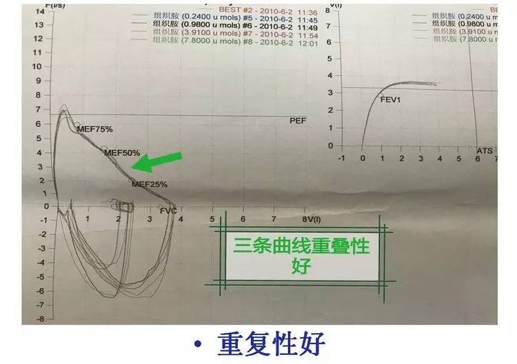 看肺功能报告单就头大?这篇文章来帮你「答疑解惑」_检查