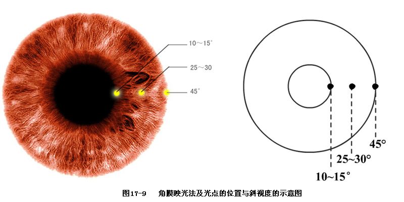 斜视的原理_什么是斜视 内斜视 外斜视 斜视的症状有哪些