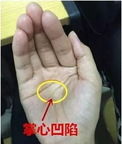 你手上有"三角纹"吗?