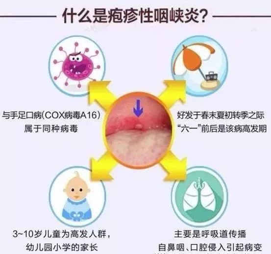 【卫生保健】手足口,疱疹性咽颊炎秋日来袭,宝妈们都需要注意哪些呢?