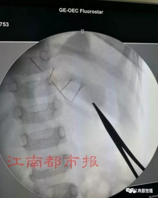 看图猜成语什么首身_看图猜成语:大部分能对5个,你就是满分!