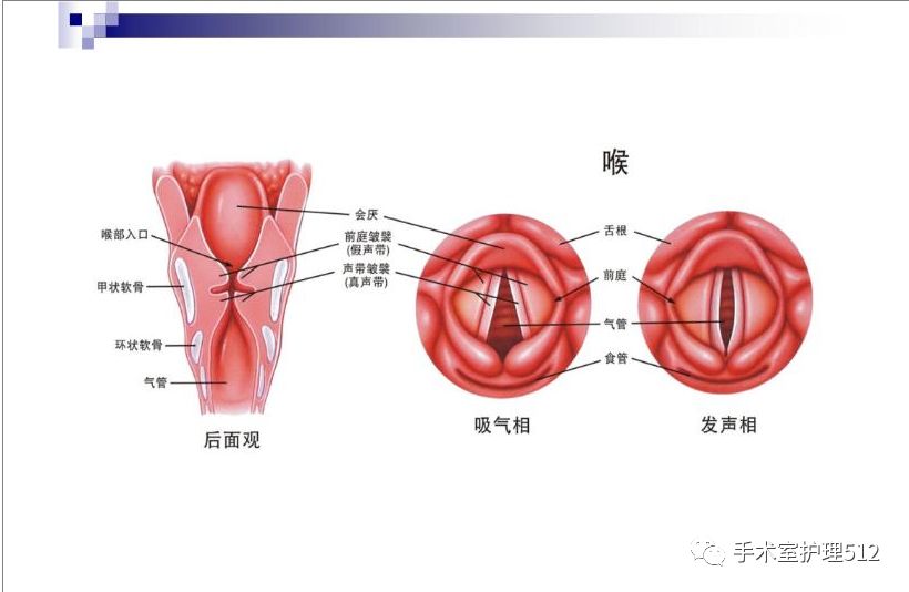 支撑喉镜下喉乳头状瘤co2激光切除术手术配合护理个案