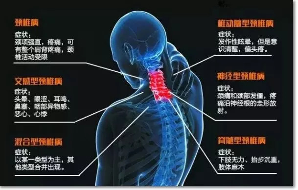 搭脉怎么看脑供血不足_脑供血不足怎么调理(3)