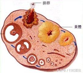 同房后酿成的"血案""黄体破裂",医生却不给我手术?