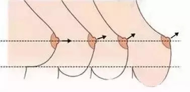一般乳房最低点是下褶皱,如果你的乳房越来越耷拉盖过了下褶皱,考虑是