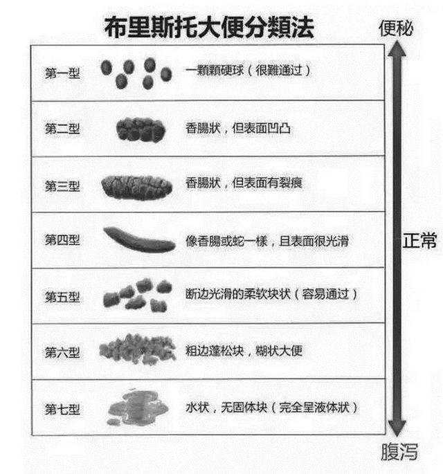 「察"颜"观"色"辨"形」便便透露着你的健康_水样