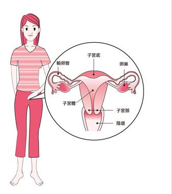 重庆五洲妇儿医院专家表示:子宫下垂5大症状,你不可忽视!