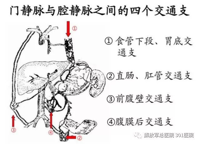 我院成功完成一例胃底静脉曲张内镜下硬化剂加组织胶注射术