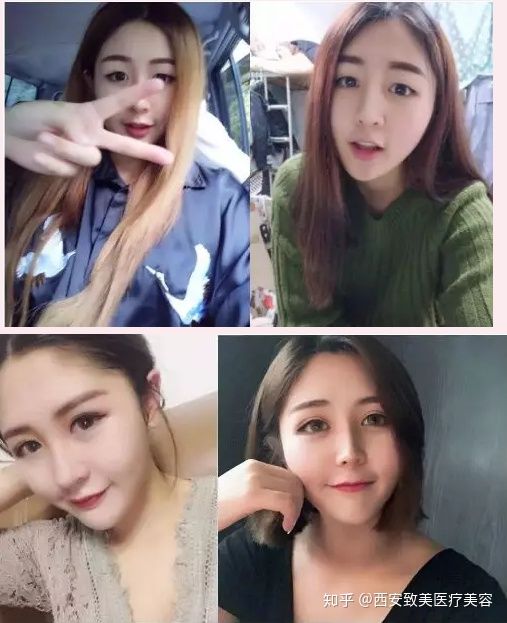 西安致美医疗美容整容:现在的漂亮女生有一些都是微整形的吗?