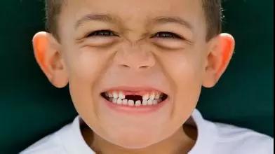 淮安儿牙矫正:为什么小时候掉牙了,必须要扔到屋顶上?