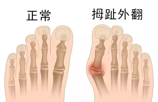 中医治疗腰椎病的原理是什么_幸福是什么图片