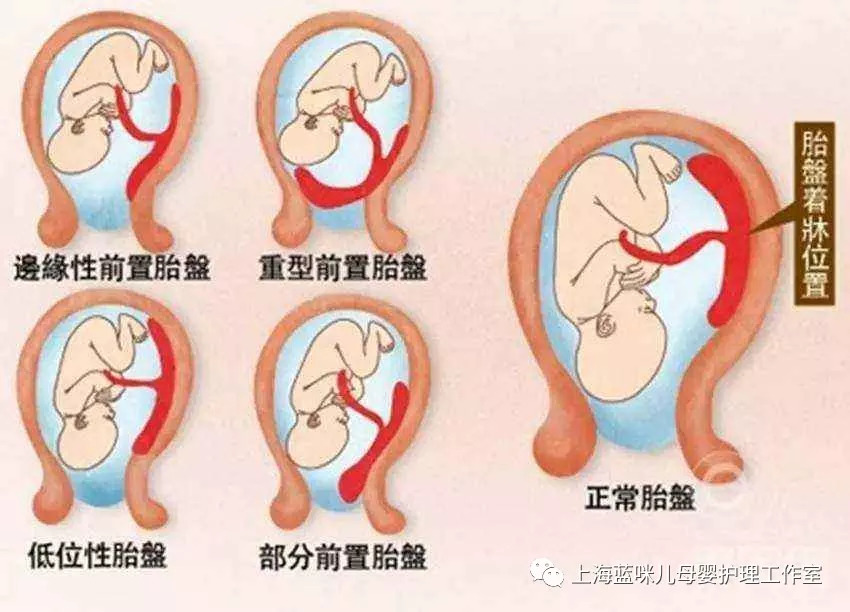 到了孕晚期更要注意胎盘成熟度,关系到胎儿后期营养够