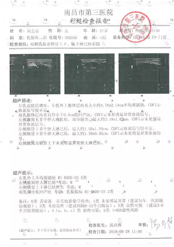 德安大西门石桥路的乳腺癌晚期患者自述,经过女主人公