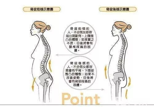 产后妈妈必知的那些事儿盆底肌修复和骨盆修复的差别