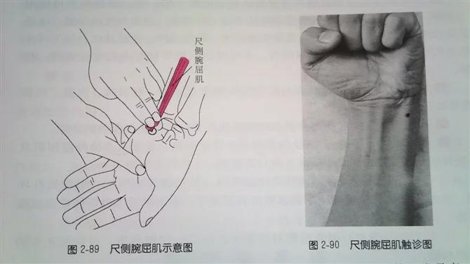 1,腕屈曲 尺侧腕屈肌:起点:肱骨内上髁,前臂深筋膜.止点:豌豆骨.