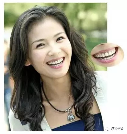 牙齿美容?刘涛亲身经历告诉你牙齿美容的血泪史!