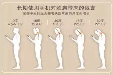 在"低头族式生活方式"盛行的时代,10个成年人,8个都有脖子前倾的问题