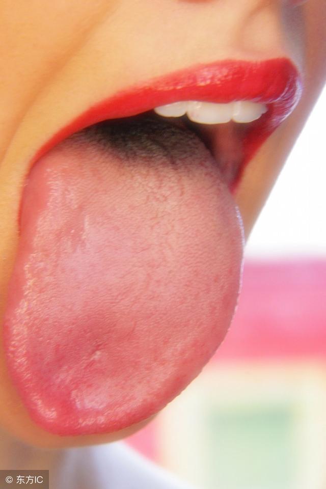 舌頭上出現斑點可能是嚴重疾病的徵兆 健康 第4張