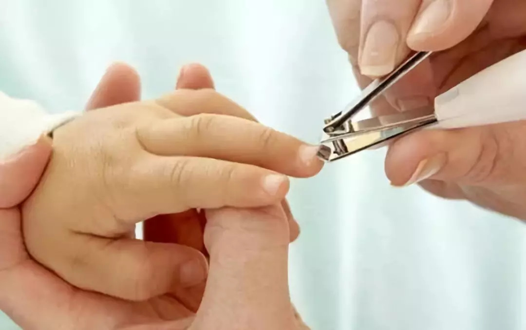 修剪指甲时,最好留出一毫米左右,脚趾甲最好剪成方头.