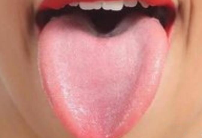 舌头:人体健康的自查表,出现这7种征兆最好去看医生!