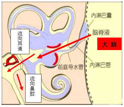 感冒流鼻涕,流出了脑脊液?