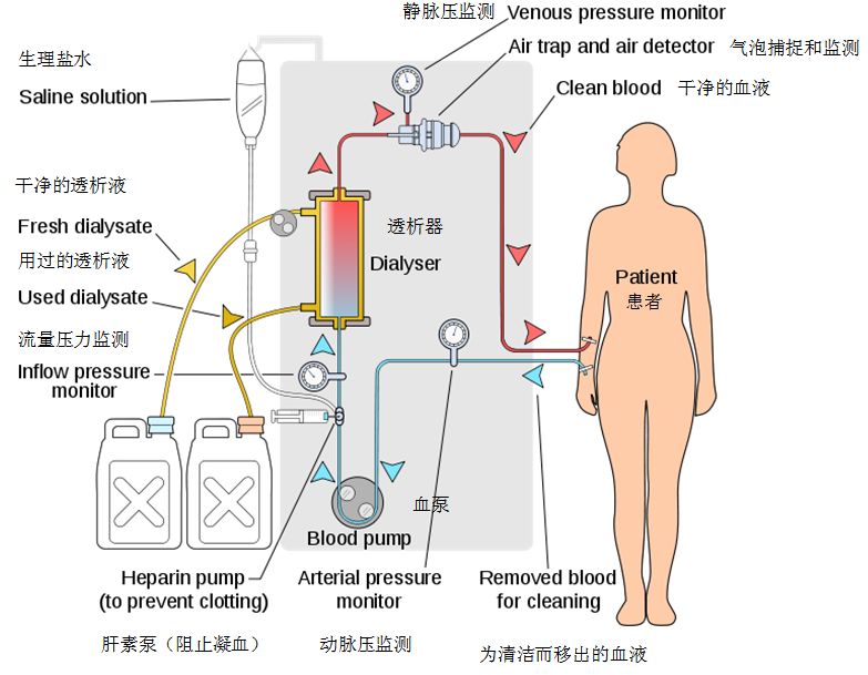 您了解人工肝血液净化治疗吗