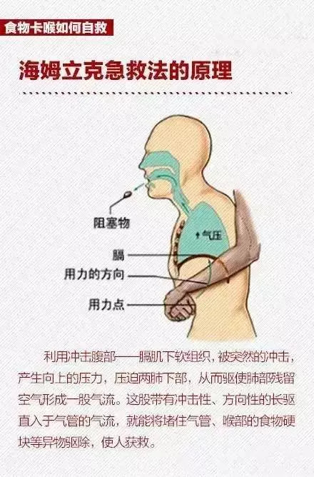 中风病人口吐黑褐色物(2)