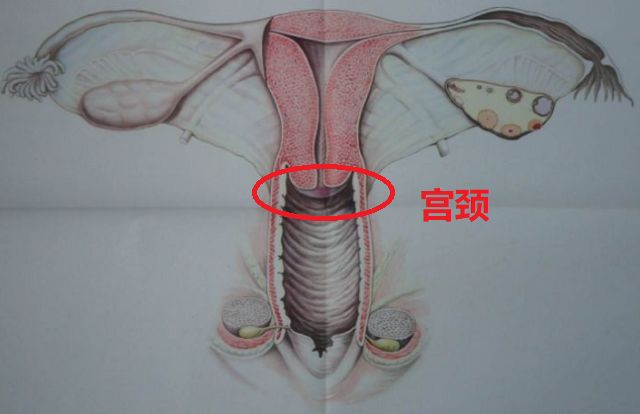 子宫两个角的地方是输卵管,输卵管就像一个展翅飞翔的鹰一样,在末端
