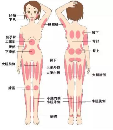 另外,它还可以用在大腿,腹部,膝盖,臀部,背部等部位.