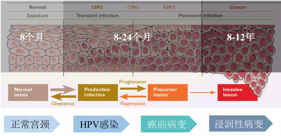 宫颈癌最喜欢的4种女人,别忽视它的早期症状