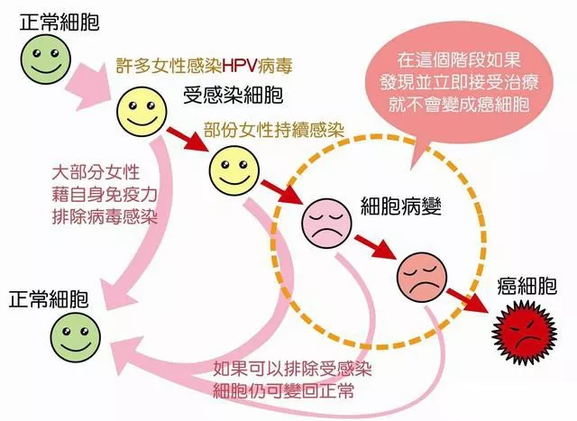 3%的宫颈癌的发生可归因于hpv感染;60%～70%的女性,在其一生中都曾