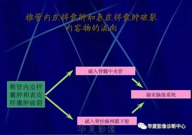 椎管内皮样囊肿和表皮样囊肿及破裂后的mri诊断及签别