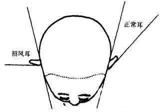 招风耳的人很"招财",但最好是要有耳垂,这种面相特征的人不管是自主