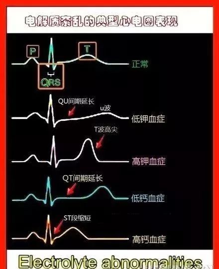 图解版心血管系统知识汇总,值得收藏