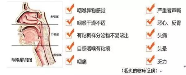 我国慢性咽炎患者 3亿左右, 95%患者感觉咽部有异物咳不出,咽不下