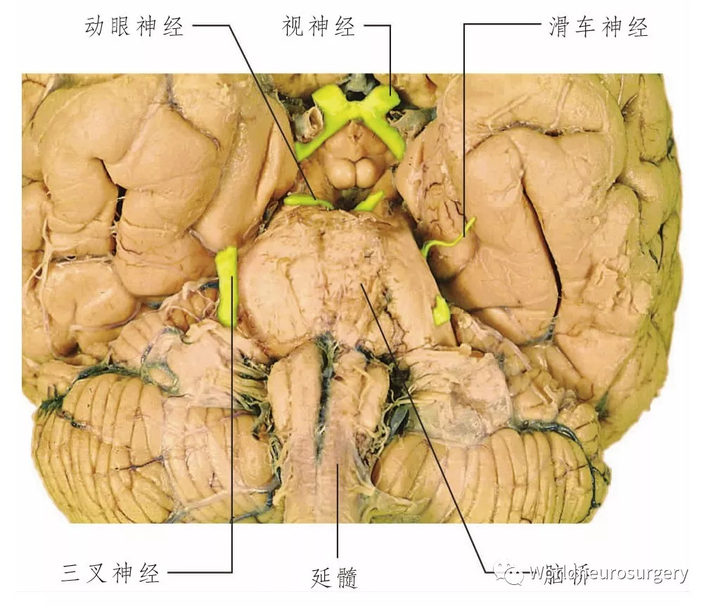 彩图经典版 | 脑神经和脑神经核解剖 atlas