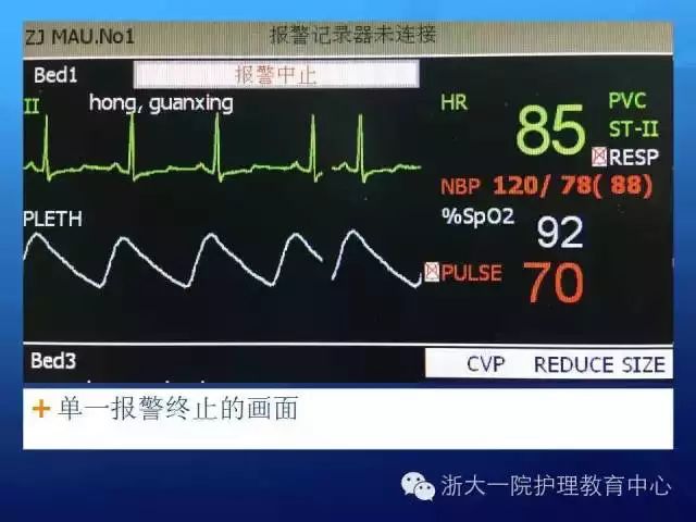 学习| 心电监护报警分析及处置