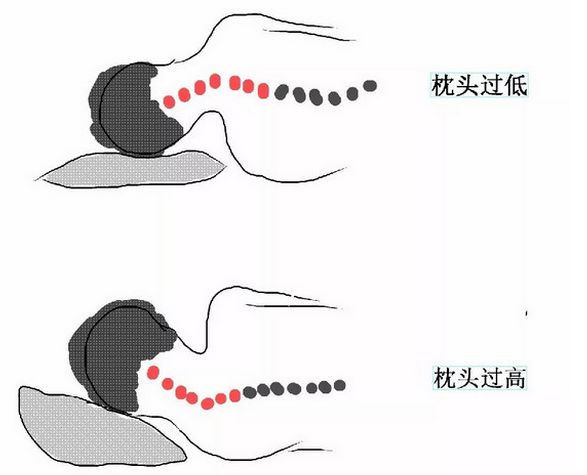 90%的颈椎病,是枕头睡出来的!真相太可怕了!