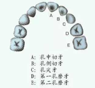 五六岁小孩牙疼怎么办