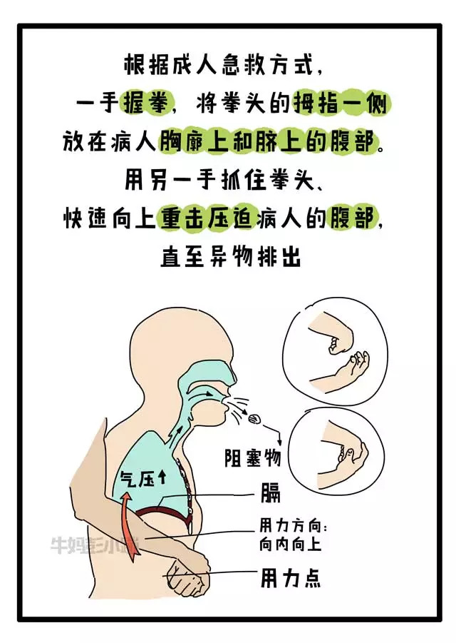 今天我想把一些简单的噎食急救方法画出来,所有的父母都应该学到,如果