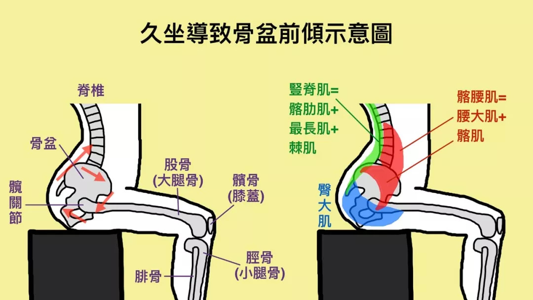 久而久之,臀大肌会越来越无力.