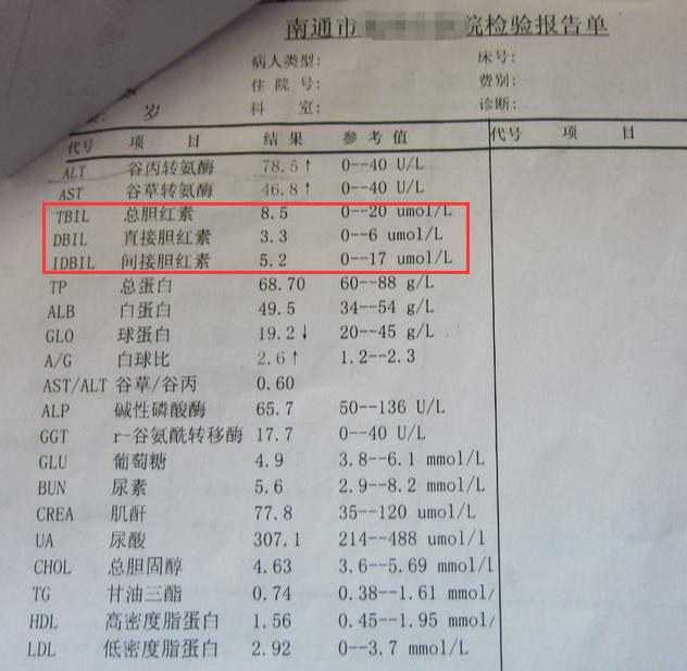 胆红素居高不下说明肝出问题了1个简单方法能护肝保命