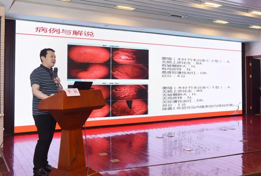 苏州大学附属第一医院消化内科副主任李锐教授做了《慢性胃炎的内镜